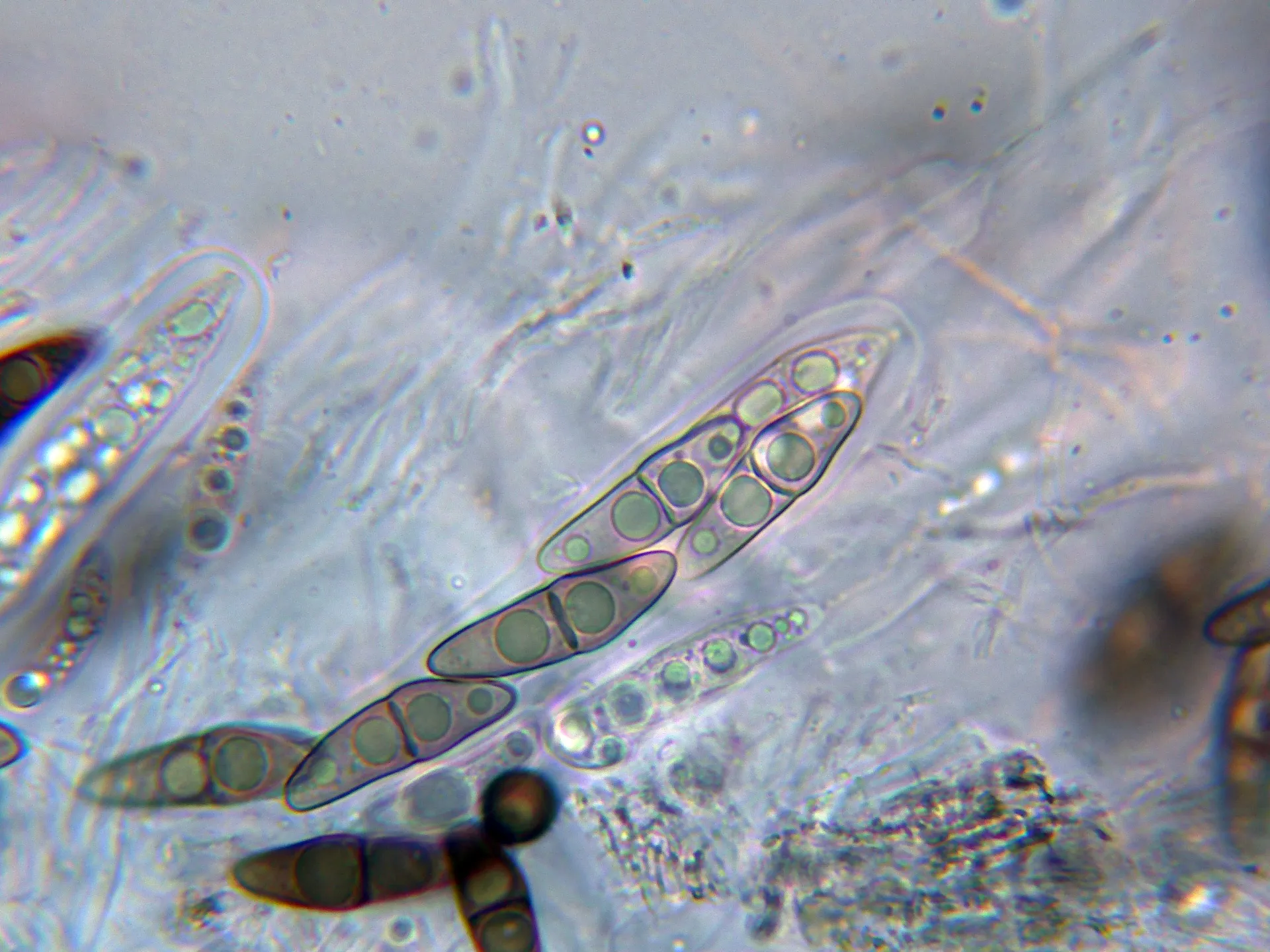 Microscopía de Trematosphaeria pertusa - 10 - Asco-002